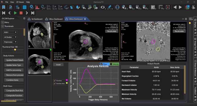 HarmonyCVI – TechVision Plus